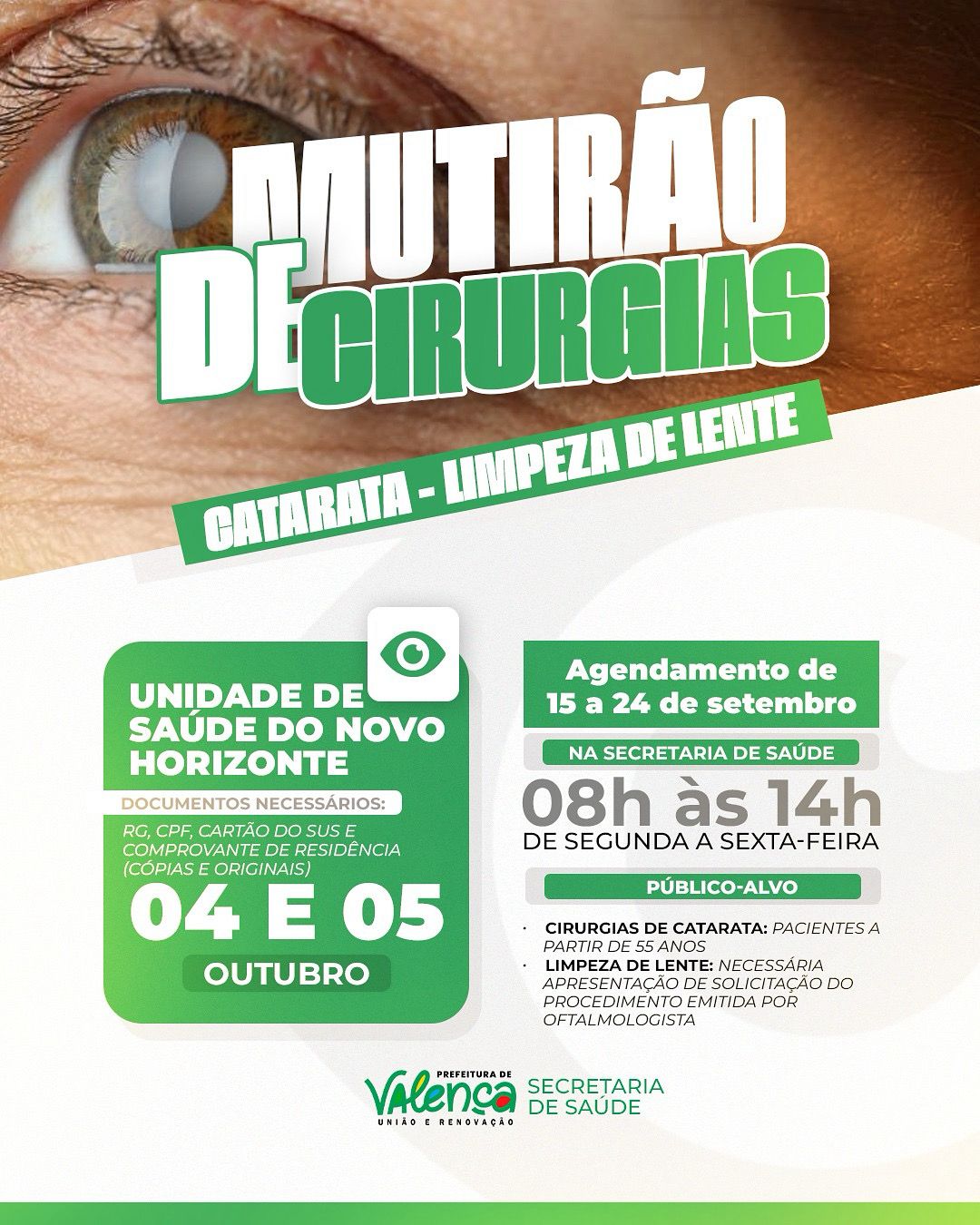 Valença realizará grande mutirão de cirurgias de catarata e limpeza de lente