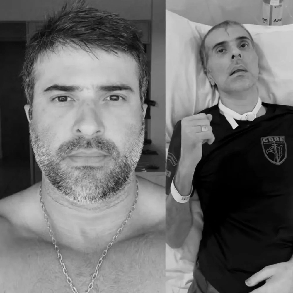 Luto na segurança pública: morre Felipe Marques Monteiro, policial civil ferido 
na cabeça durante operação no RJ